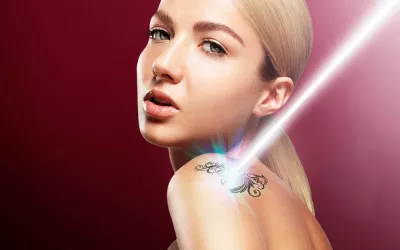 Técnica de elimincion de un tatuaje Cómo eliminar un tatuaje