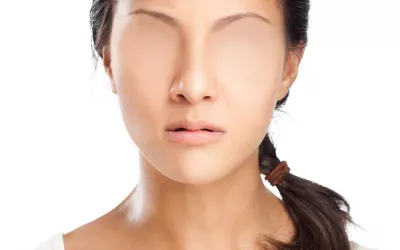 Prosopagnosia, el extraño fenómeno de ‘ceguera facial’ Mujer con parte de los rasgos faciales difuminados