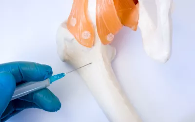 Qué es la biopsia de médula ósea Biopsia de médula ósea
