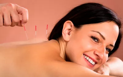 Acupuntura Acupuntura