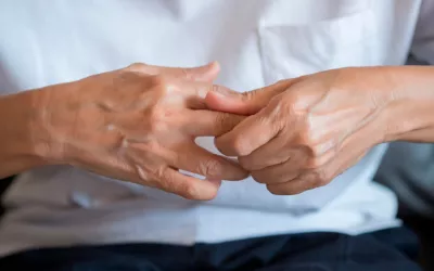 Artritis reumatoide Paciente con artritis reumatoide