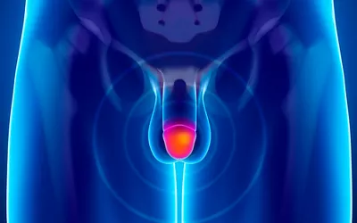 Qué es la balanitis