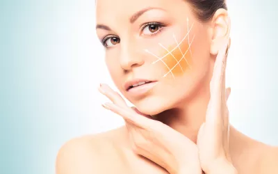 Bichectomía Bichectomía o extracción de bolas de Bichat