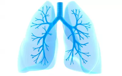 Cáncer de pulmón Qué es el cáncer de pulmón