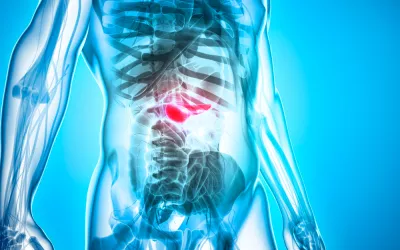 Cáncer de pancreas