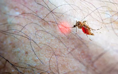 Qué es la fiebre de chikungunya Chikungunya