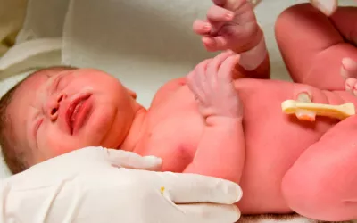 Test de Apgar Test de Apgar