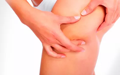 Claves para eliminar la celulitis Cómo eliminar la celulitis