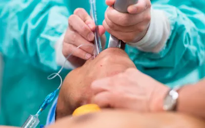 CPRE: cuándo y cómo se realiza