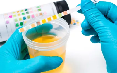 Análisis de orina Análisis de orina