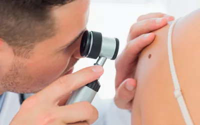 Cáncer de piel Cáncer de piel