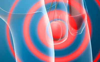 Cáncer de testículo