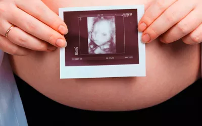 Ecografía durante el embarazo