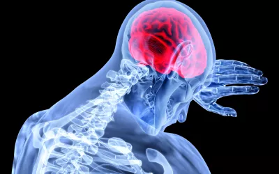 Encefalitis Qué es la encefalitis