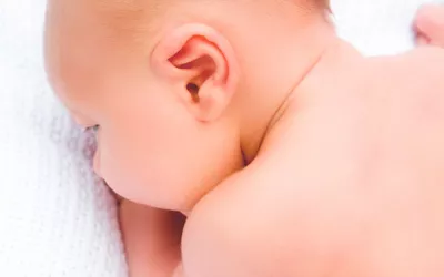 Bebé con espina bífida Espina bífida