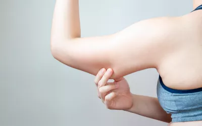 Flacidez corporal, cómo evitar la pérdida de firmeza de la piel Flacidez corporal: cómo combatirla