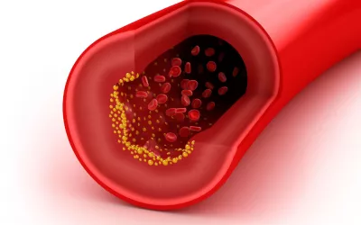 Hipercolesterolemia