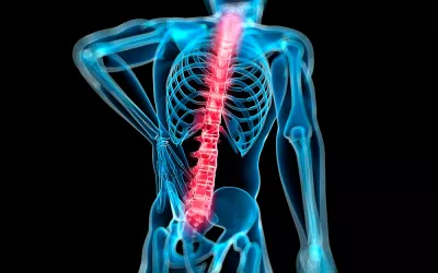 Mieloma múltiple Mieloma múltiple