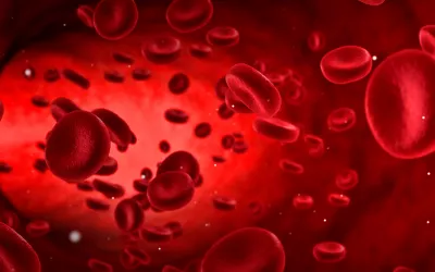 Policitema vera, exceso de glóbulos rojos Policitema vera, exceso de glóbulos rojos