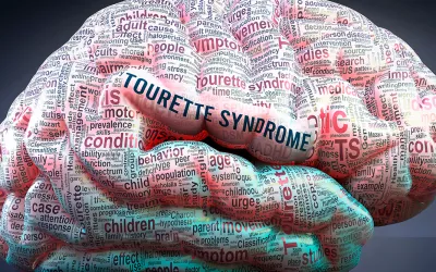 Síndrome de Tourette Qué es el síndrome de Tourette