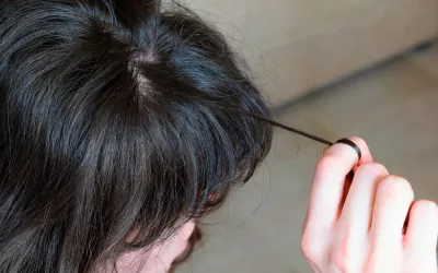 Persona con tricotilomanía