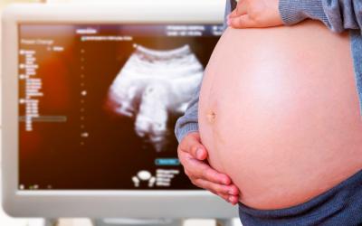 Ecografía de un mujer embaraza con el síndrome del gemelo evanescente