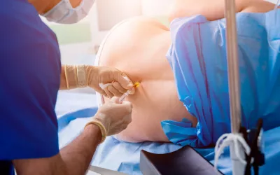 Mujer con anestesia epidural