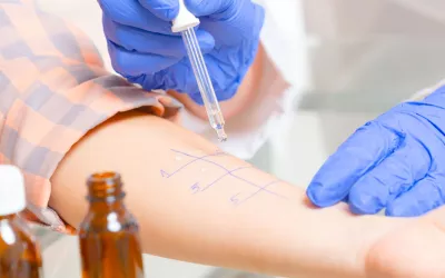 Pruebas cutáneas de alergia