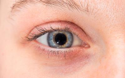 Pupilas dilatadas
