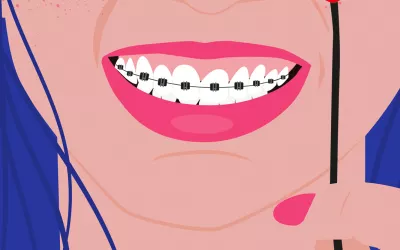 Qué comer con brackets y qué alimentos evitar Qué comer con brackets