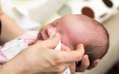 Madre aplicando pomada protectora para evitar una conjuntivitis en su bebé