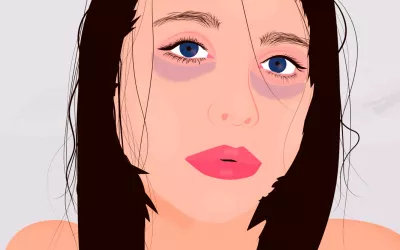 Ilustración de una mujer con ojeras