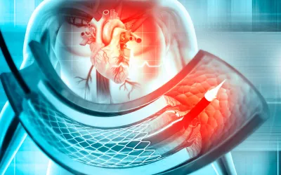 Cateterismo cardíaco