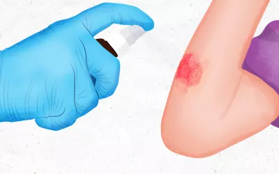 Cristalmina para heridas: cuándo usarla Aplicación de la cristalmina