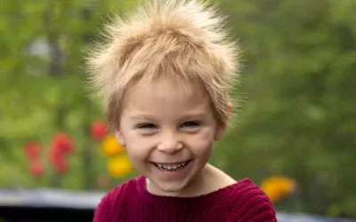 Síndrome del cabello impeinable, ¿a qué se debe el pelo loco? Síndrome del cabello impeinable