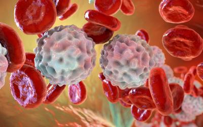 Linfocitosis: causas de los linfocitos altos y cómo bajarlos