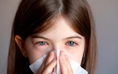 Arcturus, la nueva variante del coronavirus que afecta más a los niños Niña con sintomas de la variante Arcturus