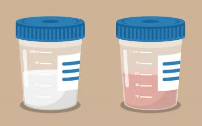 Botes de semen con colores blanco y rojo