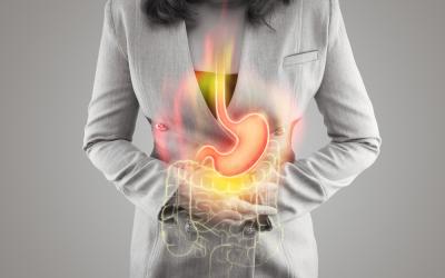 Ilustración del estómago y el intestino grueso sobre el cuerpo de una mujer