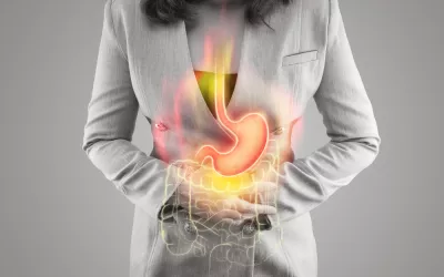 Ilustración del estómago y el intestino grueso sobre el cuerpo de una mujer