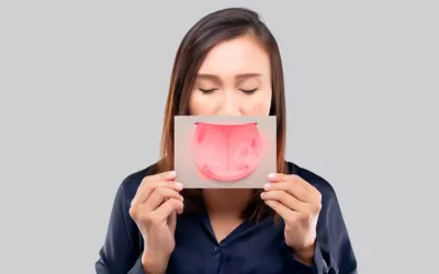 Mujer sosteniendo una hoja impresa con una lengua infectada por úlceras