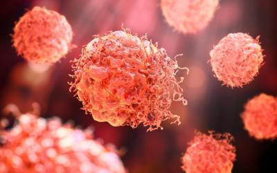 Células cancerosas de melanoma creciendo sin control