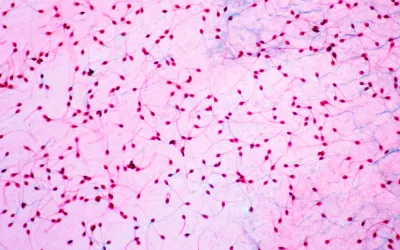 Vista del semen desde un microscopio