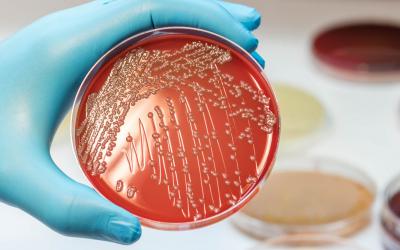 Bacteria E. coli en el laboratorio