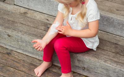 Dermatitis atópica en una niña