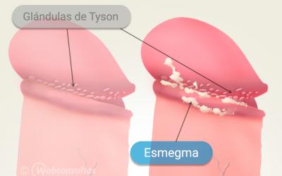 Ilustración del esmegma