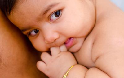 Niño con poliomelitis