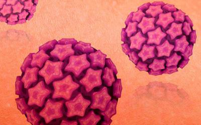 Qué es la infección por VPH