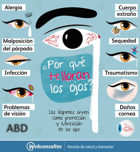 Infografía ojos llorosos