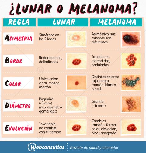 Infografía melanoma